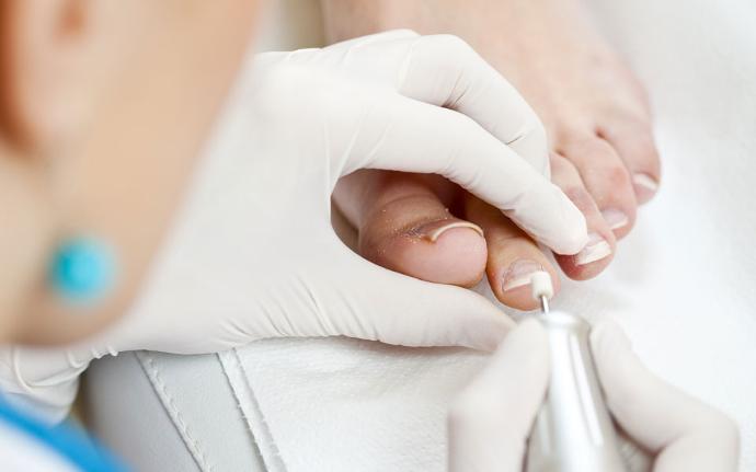 Slenders Footcare & Cosmetics gelpolish op teennagels